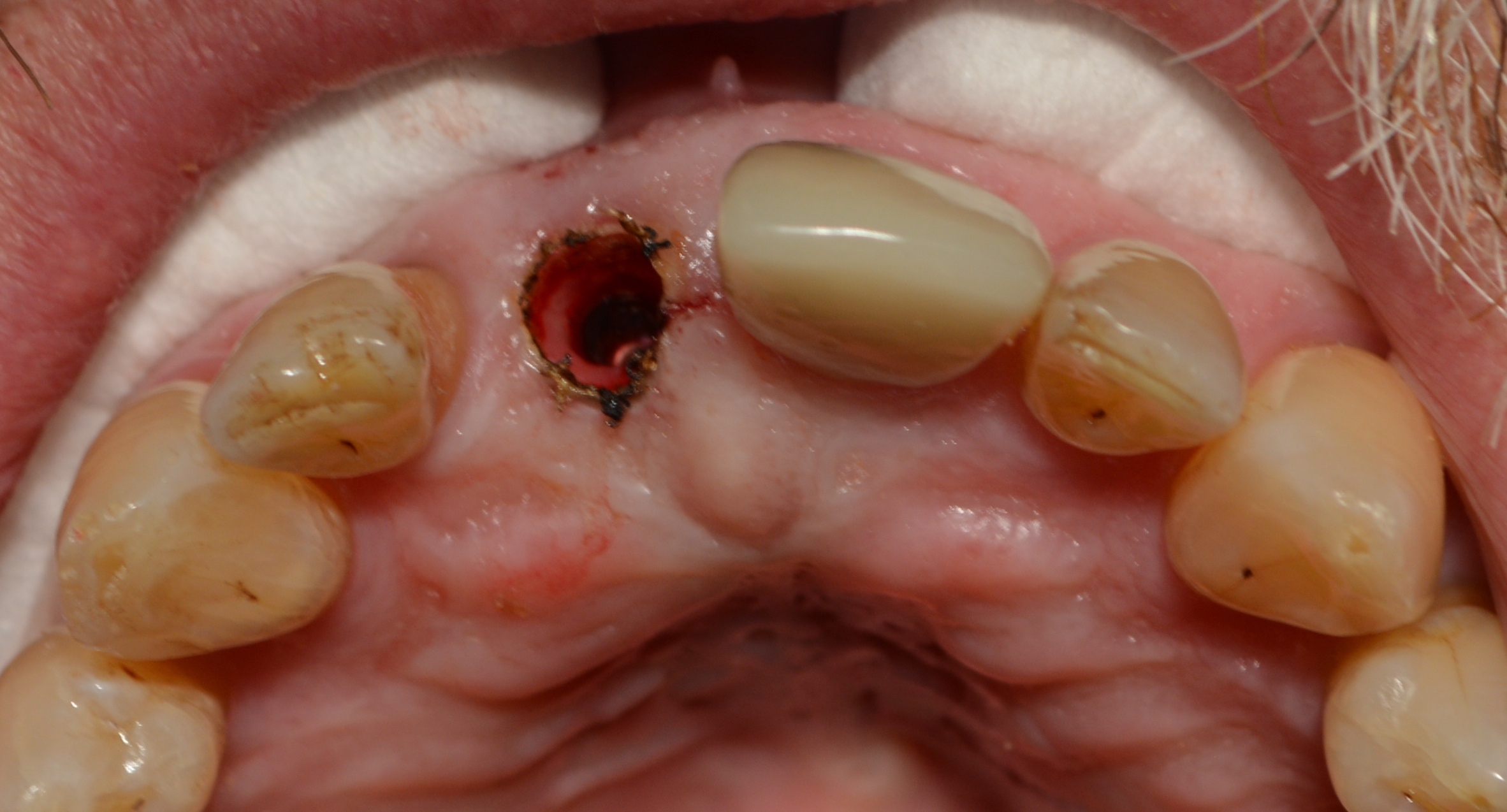 Fig. 6